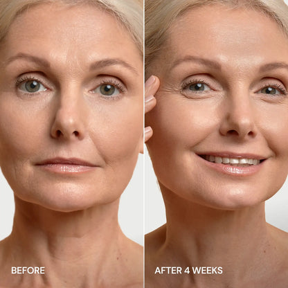 24K Gold V-Line Lifting Mask