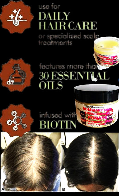 Wholesale-Organics Rosemary Mint Strengthening Hair Pomade, Grease-Scalp & Hair Treatment (24 pack)