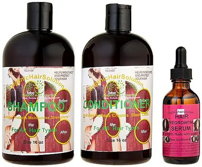 BUNDLE SET SHAMPOO & CONDITIONER & Hair & Scalp Serum (pack 3)